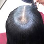 Scalp Treatment