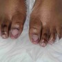 Toenail enhancement