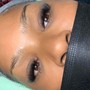 Facial treatment/ microdermabrasion