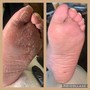 Toe Gel enhancement