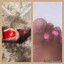 Diabetic Pedicure(waterless)