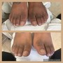 Diabetic Pedicure(waterless)