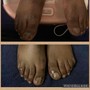 Toe Gel enhancement