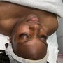 Intro Facial (Before receiving a peel)