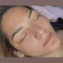 Eyebrow Tattooing