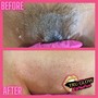 Brazilian Wax, Underarm Wax