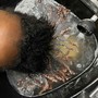 Scalp Treatment