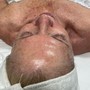 Back Facial