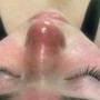 Eyelash Extension Removal