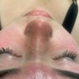 Eyelash Extension Removal