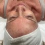 Back Facial