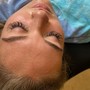 Eyelash Fill