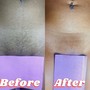 Brazilian Wax, Vajacial