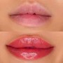 Lips