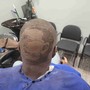 Men's hair replacement units