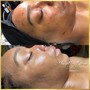 Facial