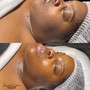 Diamond Glow Microdermabrasion Facial