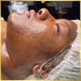 Diamond Glow Microdermabrasion Facial