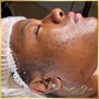 Diamond Glow Microdermabrasion Facial