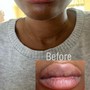 Eyelash extension removal