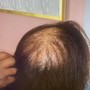 Scalp Treatment