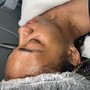 Intro Facial (Before receiving a peel)