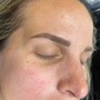 Eyebrow: Microblading