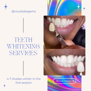 What Does Snow Teeth Whitening Password Mean?