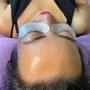 Eyelash Extension Removal