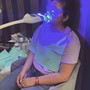 Microdermabrasion