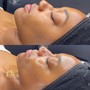 Facial