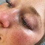 Eyelash Extension Removal