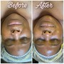 Back Facial “ Treatment”