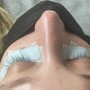 Eyelash Extension Removal