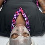 Acne Facial