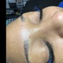 Micro-Needling Face & Neck Combo