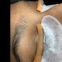 Dermaplaning