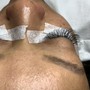 Eyelash Extension Removal