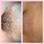 Brazilian Wax ONLY (Must Be 18+)