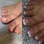 Toe reconstruction on big toes only! Gel polish on small toes