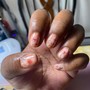 Nail Repair