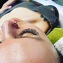 Oxygen Facial