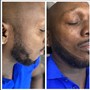 BEARD  MICROSHADING (PMU)