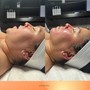 Back Facial