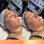 3 Premium Facial