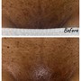 Men’s Brazilian Wax & Penacial