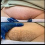 Men’s Brazilian Wax