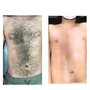 Men’s Brazilian Wax(front and back)