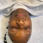 Nano Facial