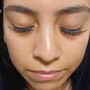 Eyelash lift